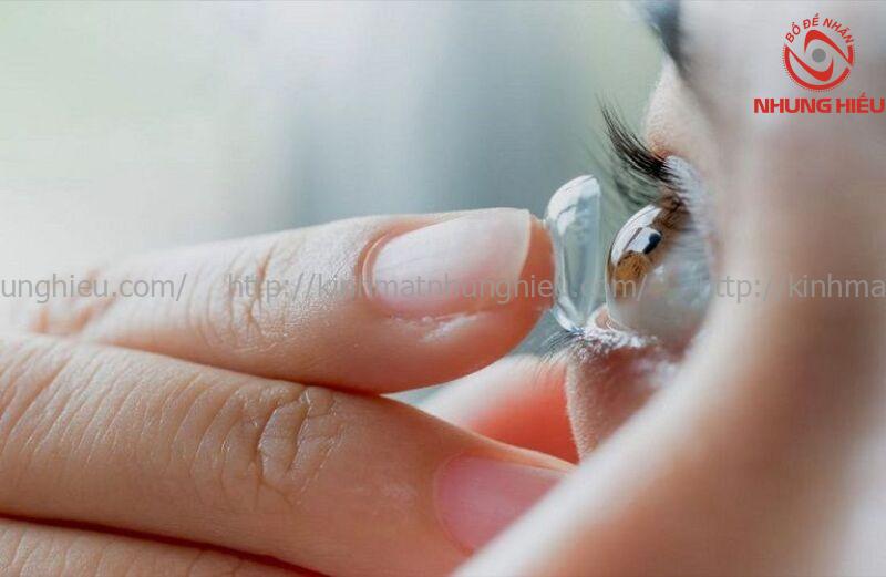 mắt cận đeo thấu kính gì