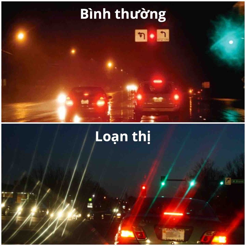 Triệu chứng loạn thị
