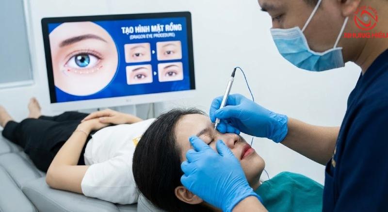 Phương pháp thẩm mỹ tạo hình mắt rồng