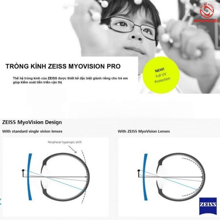 Tròng kính ZEISS MYOVISION PRO