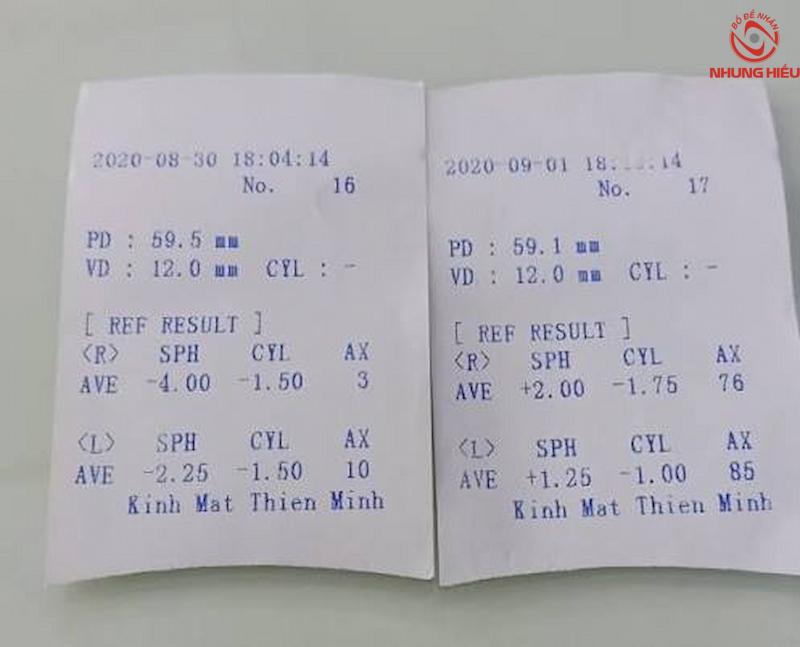 Chỉ số CYL là gì