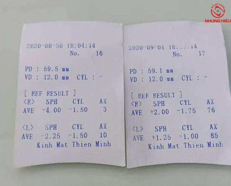 Quy trình thực hiện SPH
